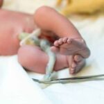 Cruzar las Piernas o Levantar los Brazos Pueden Estrangular al Bebé con el Cordón Umbilical: Principales Mitos